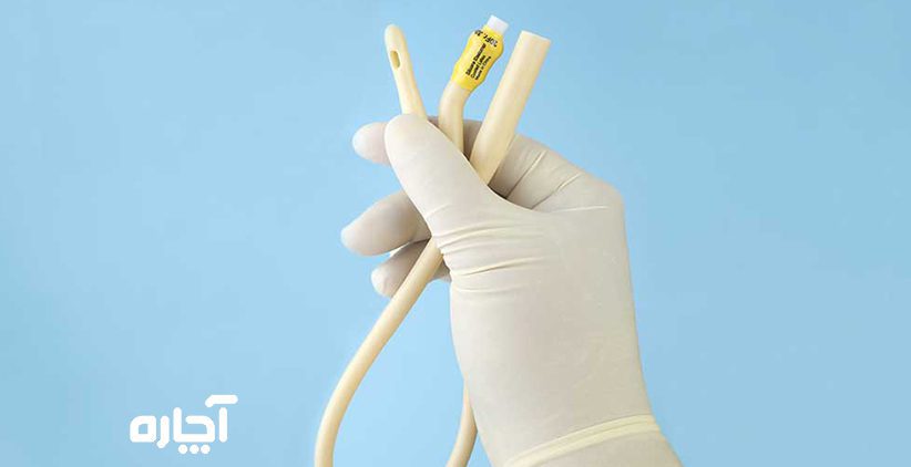 هزینه سوندگذاری در منزل تعویض سوند در منزل