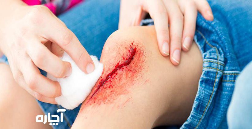 تعویض پانسمان بخیه در منزل خدمات کشیدن بخیه در منزل هزینه کشیدن بخیه در منزل