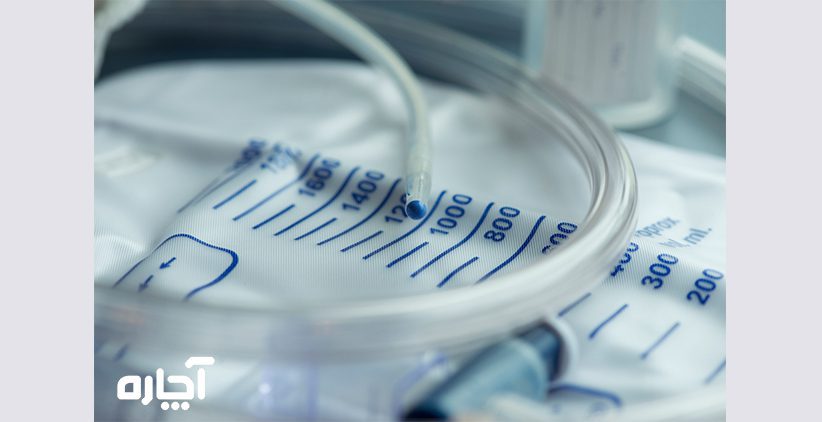 هزینه نصب سوند در منزل سونداژ زنان مردان سوند ادراری