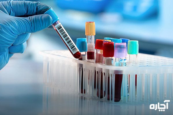 انواع آزمایش خون چیست هر اژمایش چه چیزی را نشان می‌دهد؟
