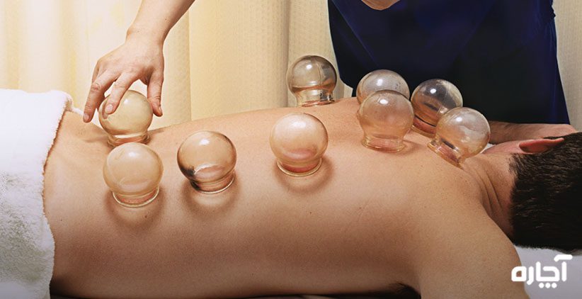 فواید حجامت در منزل برای زنان چیست حجامت در محل حجامت در خانه 