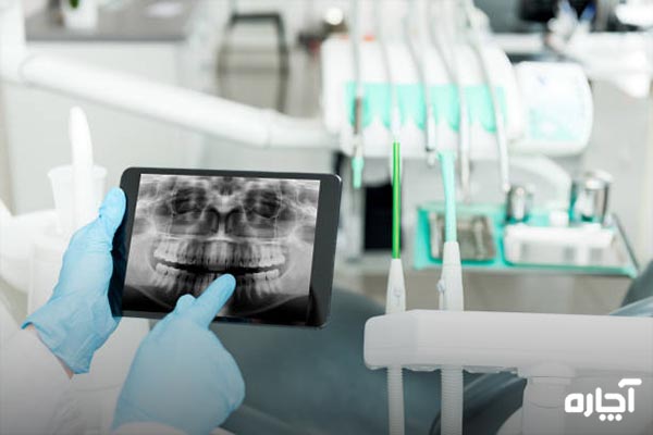 عکس رادیوگرافی دندان خراب را کجا بگیریم؟