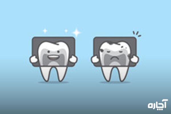 عکس رادیولوژی دندان خراب را حتما باید بگیریم؟