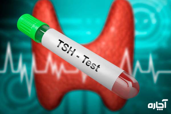 فاکتور TSh در آزمایش خون چه چیزی را نشان می‌دهد