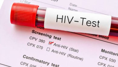 انواع آزمایش های ایدز کدام اند