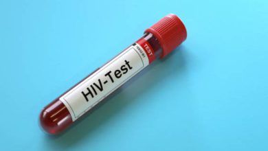تشخیص ایدز با آزمایش خون ساده باید ناشتا باشیم؟