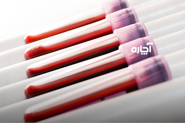 آزمایش اسید لاکتیک خون چیست و برای چه تجویز می شود