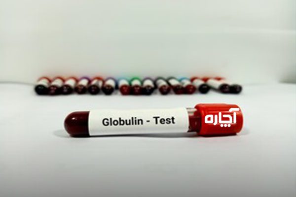 آزمایش گلوبولین چیست؟
