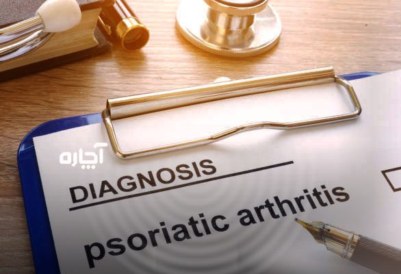 تشخیص بیماری ارتریت پسوریاتیک چیست توسط پزشک