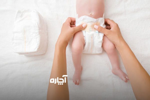 درمان عفونت قارچی زیر پوشک نوزاد