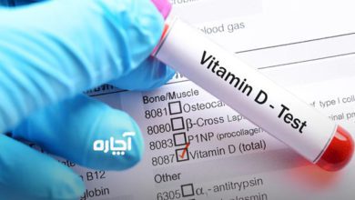 نحوه-انجام-آزمایش-ویتامین-دی-چگونه-است؟