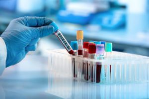 آزمایش خون MPV چیست؟