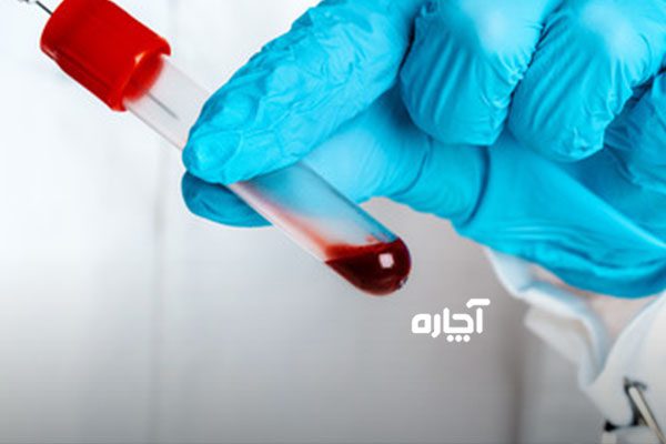 آزمایش خون برای سطح ویتامین a - محدوده نرمال ویتامین A در خون