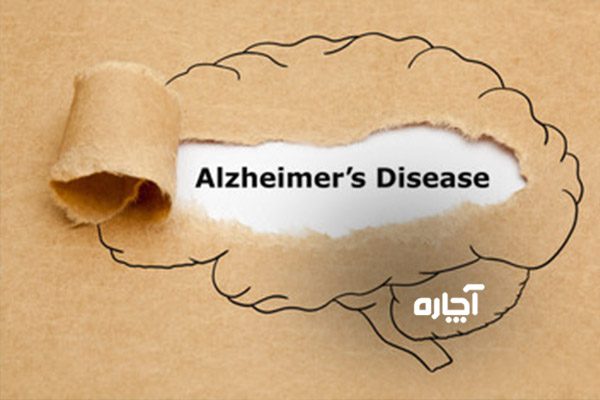 آیا بی هوش شدن باعص آلزایمر می‌شود؟
