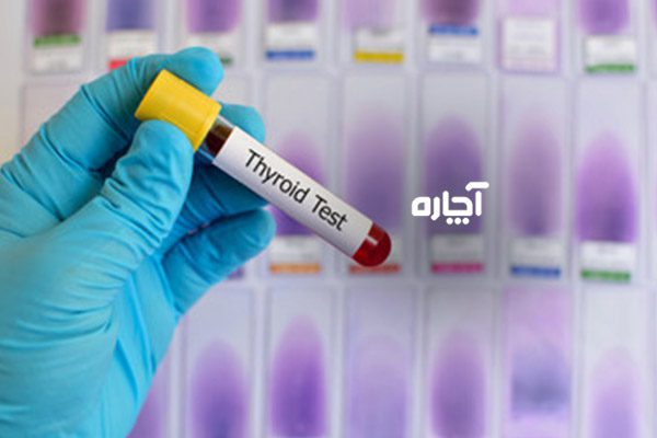 آمادگی برای آزمایش تیروئید نمونه آزمایش تیروئید خون است