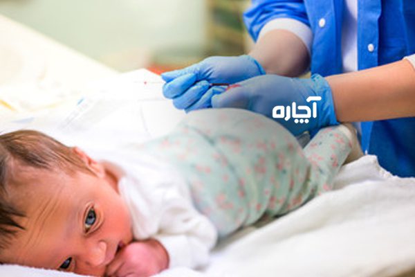 آزمایش بیلی روبین نوزاد برای چیست