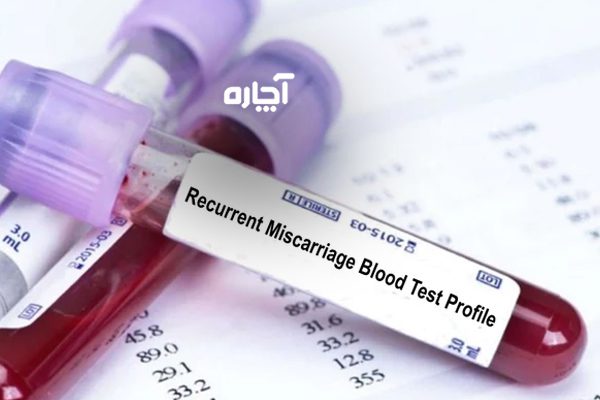 آزمایش خون بعد از سقط مکرر جنین 
