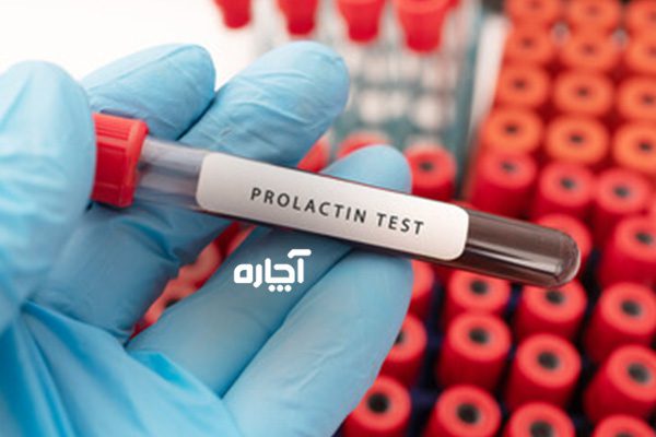 آزمایش خون پرولاکتین برای تنبلی تخمدان 
