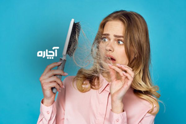 درمان ریزش موی ناشی از تخمدان پلی کیستیک