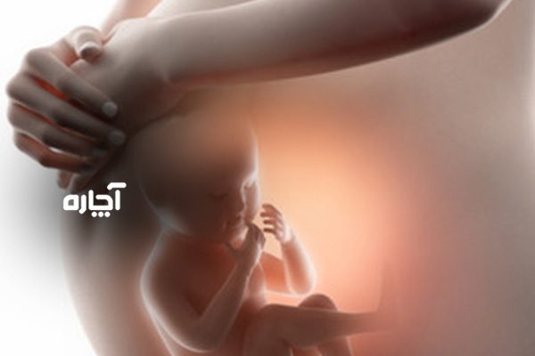 اثر خوردن خرمالو بر سلامت جنین - آیا بر رشد و زیبایی آن اثر دارد؟