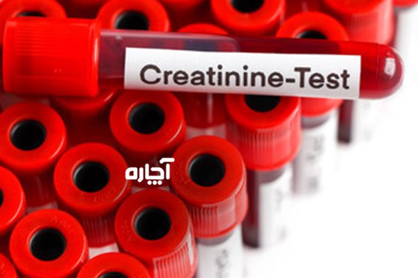 سطح کراتینین در خون ورزشکاران با آزمایش خون مشخص می شود